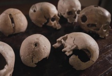 Bajo el bisturí - Una historia de la cirugía - Parte 1